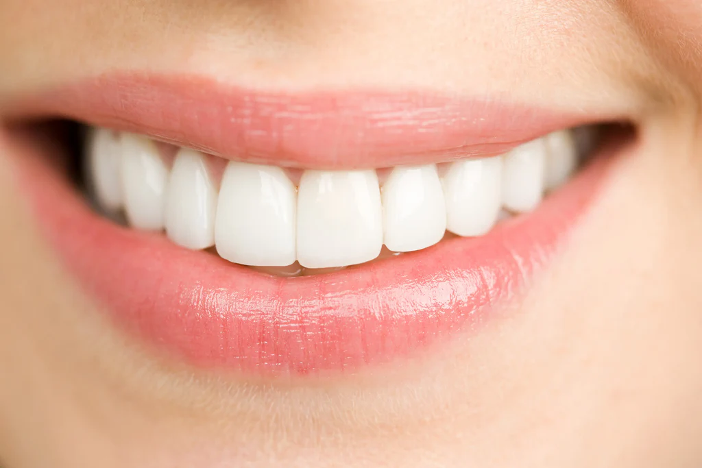 Como cuidar do seu sorriso no dia a dia - miniatura 2