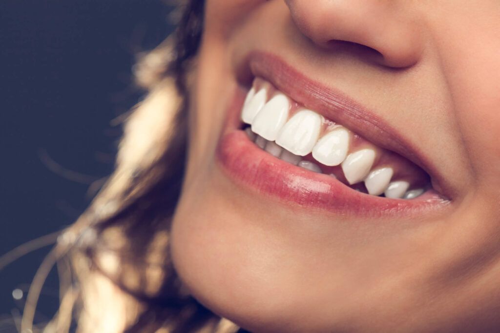 Implantes Dentários - miniatura 1